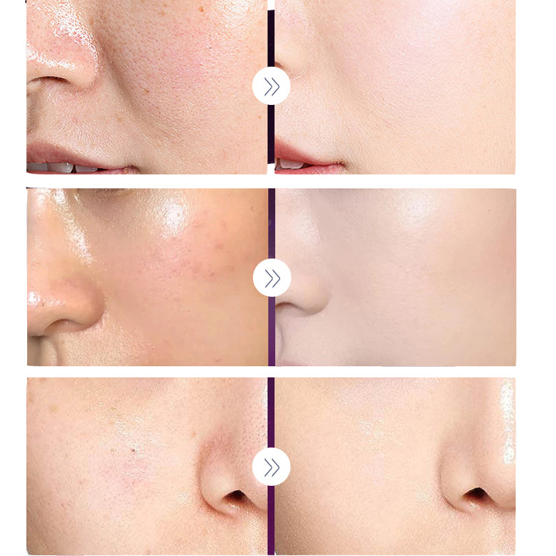 คอนซีลเลอร์บำรุงผิวหน้าครีมบำร - Luxury Skincare Moisturizer บทวิจารณ์และราคา
